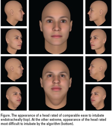 Difficult Airway Pictures