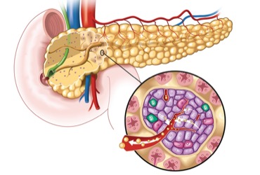 Ultrasound-Guided ESP Block Effective for Pancreatitis Pain