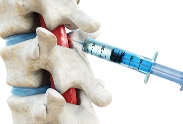 Infection Risk Exceptionally Low With Neuraxial Anesthesia, Much Higher ...