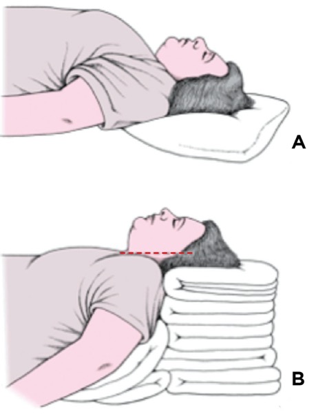 Is This Patient Truly Difficult to Intubate?